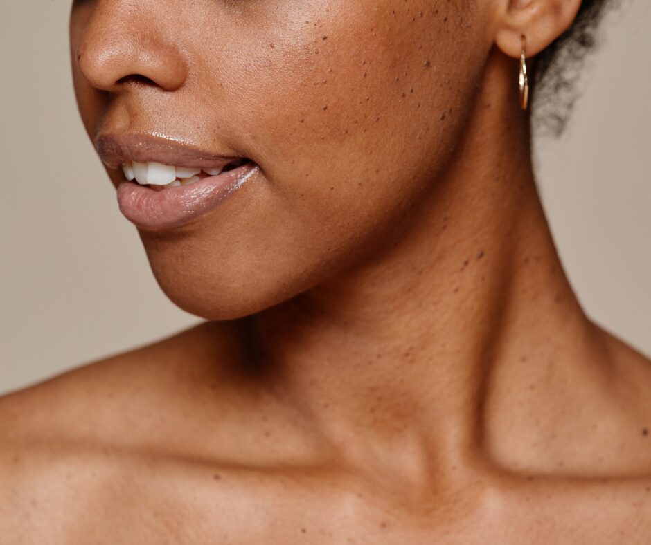 How to tell if you have dry or dehydrated skin